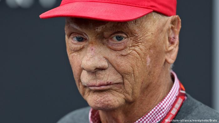 Kondisi Niki Lauda dikabarkan membaik pasca operasi transplantasi paru (ist)