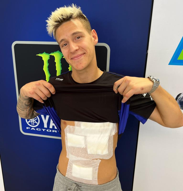 Fabio Quartararo (Yamaha) dengan luka lecet di sekujur tubuhnya. (Foto: ist)